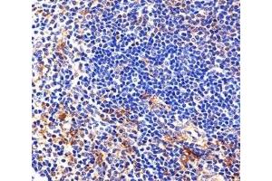 Immunohistochemical analysis of paraffin-embedded mouse spleen section using Lyn antibody (LYN antibody  (AA 229-263))