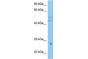 Host:  Rabbit  Target Name:  UBP48  Sample Tissue:  Human Lymph Node Tumor lysates  Antibody Dilution:  1ug/ml (USP48 antibody  (N-Term))