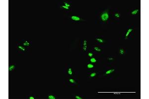 Immunofluorescence of purified MaxPab antibody to SCML1 on HeLa cell. (SCML1 antibody  (AA 1-208))