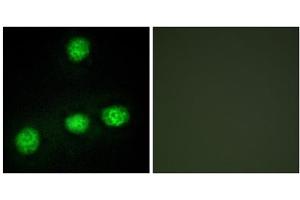 Immunofluorescence analysis of HUVEC cells, using CLK1 antibody. (CLK1 antibody  (Internal Region))