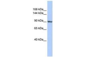 Image no. 1 for anti-TNNI3 Interacting Kinase (TNNI3K) (AA 755-804) antibody (ABIN6741016)