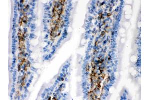Immunohistochemistry (IHC) image for anti-Caldesmon 1 (CALD1) (AA 1-120) antibody (ABIN4886498)