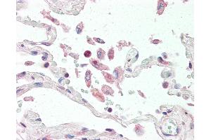 Anti-APRIL antibody IHC of human lung. (TNFSF13 antibody  (Extracellular Domain))
