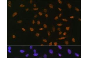 Immunofluorescence analysis of U-2 OS cells using Snail Polyclonal Antibody at dilution of 1:100. (SNAIL antibody)
