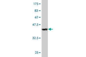 Western Blot detection against Immunogen (34. (DDX3Y antibody  (AA 1-80))