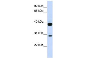 Flt3 Ligand antibody used at 1 ug/ml to detect target protein. (FLT3LG antibody  (N-Term))