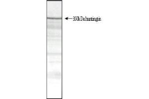 Total protein extract of normal human cerebral cortex separated as a strip on a 3- (Huntingtin antibody  (AA 1844-2131))