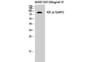 Western Blotting (WB) image for anti-AXL Receptor tyrosine Kinase (AXL) (pTyr691) antibody (ABIN3179699) (AXL antibody  (pTyr691))