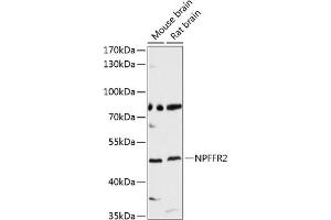 Western blot analysis of extracts of various cell lines, using NPFFR2 antibody (ABIN6128377, ABIN6144766, ABIN6144767 and ABIN6214924) at 1:3000 dilution. (NPFFR2 antibody  (AA 1-140))