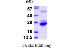 Glucosamine-Phosphate N-Acetyltransferase 1 (GNPNAT1) (AA 1-184) protein (His tag)