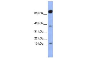 WB Suggested Anti-NKX6-3 Antibody Titration:  0. (NK6 Homeobox 3 antibody  (Middle Region))