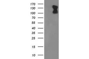 Western Blotting (WB) image for anti-phosphodiesterase 2A, CGMP-Stimulated (PDE2A) antibody (ABIN1500084) (PDE2A antibody)