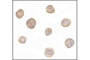 Immunohistochemistry (IHC) image for anti-BCL2-Like 11 (Apoptosis Facilitator) (BCL2L11) (AA 2-198) antibody (ABIN492532) (BIM antibody  (AA 2-198))