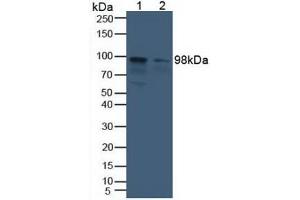 Western blot analysis of (1) Human Liver Tissue and (2) Human HeLa cells. (Aconitase 1 antibody  (AA 251-443))