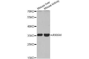Western blot analysis of extracts of various cell lines, using ANXA4 antibody (ABIN6290015) at 1:1000 dilution.