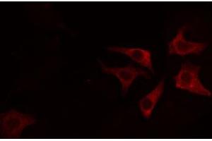 ABIN6274711 staining HeLa cells by IF/ICC. (AGPAT4 antibody  (Internal Region))