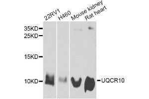 Western blot analysis of extracts of various cell lines, using UQCR10 antibody. (UQCR10 antibody)