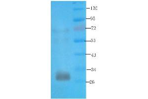 Western Blot using anti-syntaxin antibody ABIN7072248 Rat kidney lysate was resolved on a 12 % SDS PAGE gel and blots probed with ABIN7072248 at 3 μg/mL before being detected by a secondary antibody. (Recombinant Syntaxin antibody)