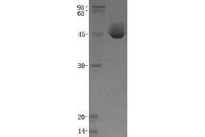 Validation with Western Blot (ACPP Protein (Transcript Variant 1) (His tag))