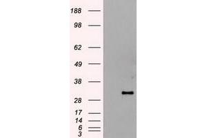 HEK293T cells were transfected with the pCMV6-ENTRY control (Left lane) or pCMV6-ENTRY HHex (RC204815) (Right lane) cDNA for 48 hrs and lysed. (HHEX antibody  (AA 100-270))