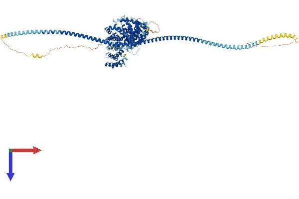 KIAA1524 Protein (KIAA1524) (AA 1-907) (His tag)