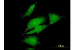 Immunofluorescence of purified MaxPab antibody to DGKA on HeLa cell. (DGKA antibody  (AA 1-735))