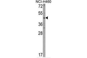 Western blot analysis of KYNU Antibody (C-term) in NCI-H460 cell line lysates (35ug/lane). (KYNU antibody  (C-Term))