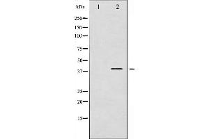 beta 2 Adrenergic Receptor antibody  (pSer346)