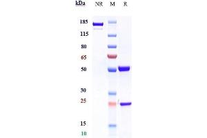 Anti-IL-5Ra/ CD125 Reference Antibody (benralizumab) on SDS-PAGE under reducing (R) condition. (Recombinant IL5RA (Benralizumab Biosimilar) antibody)