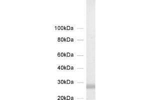 dilution: 1 : 1000, sample: crude synaptic membranes fraction of rat brain (LP1) (STX8 antibody  (Cytoplasmic Domain))