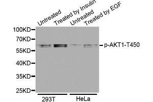 Western Blotting (WB) image for anti-V-Akt Murine Thymoma Viral Oncogene Homolog 1 (AKT1) (pThr450) antibody (ABIN1869963) (AKT1 antibody  (pThr450))