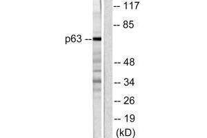 Western blot analysis of extracts from COS7 cells, using p63 antibody. (p63 antibody)