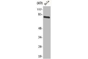 Western Blot analysis of HeLa cells using Phospho-p73 (Y99) Polyclonal Antibody (Tumor Protein p73 antibody  (pTyr99))
