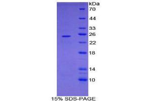 SDS-PAGE (SDS) image for Folate Receptor 4 (Delta) (FOLR4) (AA 56-234) protein (His tag) (ABIN1879942)