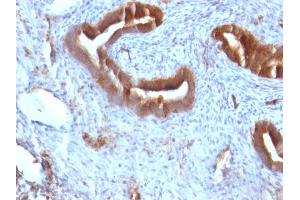 Immunohistochemistry (IHC) image for anti-beta-2-Microglobulin (B2M) antibody (ABIN6940415)