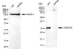 Western blotting analysis using CSNK2B antibody (ABIN7797884). (CSNK2B antibody)