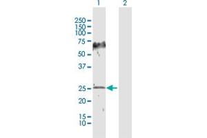 Western Blot analysis of HPGD expression in transfected 293T cell line by HPGD MaxPab polyclonal antibody. (HPGD antibody  (AA 1-266))