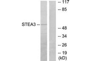 Western blot analysis of extracts from COLO205 cells, using STEA3 Antibody. (STEAP3 antibody  (AA 421-470))