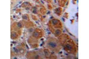 #VALUE! (KNG1 antibody  (AA 22-379))