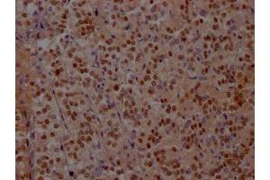 IHC image of ABIN7127582 diluted at 1:100 and staining in paraffin-embedded human adrenal gland tissue performed on a Leica BondTM system. (Recombinant ISL1 antibody)