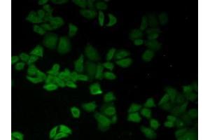 Detection of CD147 in Human Hela Cells using Polyclonal Antibody to Cluster Of Differentiation 147 (CD147) (CD147 antibody  (AA 79-280))