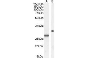 Western Blotting (WB) image for anti-Proopiomelanocortin (POMC) (C-Term) antibody (ABIN185387)