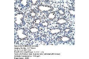 Immunohistochemistry (IHC) image for anti-SWI/SNF Related, Matrix Associated, Actin Dependent Regulator of Chromatin, Subfamily D, Member 2 (SMARCD2) (C-Term) antibody (ABIN2780464)