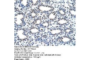 Rabbit Anti-SMARCD2 Antibody  Paraffin Embedded Tissue: Human Lung Cellular Data: Alveolar cells Antibody Concentration: 16 ug/ml Magnification: 400X (SMARCD2 antibody  (C-Term))