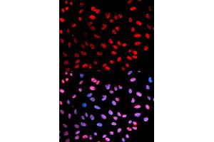 Immunofluorescence (IF) image for anti-Extra Spindle Poles Like 1 (ESPL1) (pSer1126) antibody (ABIN1876756)