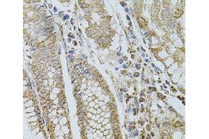 Immunohistochemistry of paraffin-embedded Human stomach using SELP Polyclonal Antibody at dilution of 1:100 (40x lens). (P-Selectin antibody)
