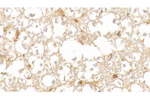 Detection of HbA1c in Human Spinal cord Tissue using Polyclonal Antibody to Glycated Hemoglobin A1c (HbA1c) (HbA1c antibody)