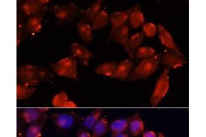 Immunofluorescence analysis of HeLa cells using ACVR2B Polyclonal Antibody at dilution of 1:100 (40x lens). (ACVR2B antibody)