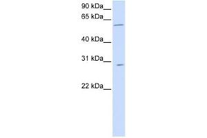 PNPLA4 antibody used at 1 ug/ml to detect target protein. (PNPLA4 antibody  (C-Term))