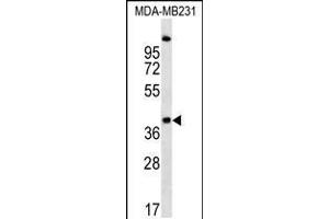 Western blot analysis in MDA-MB231 cell line lysates (35ug/lane). (RQCD1 antibody  (AA 106-134))